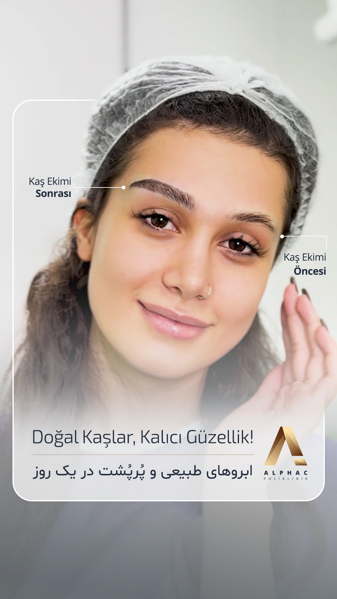 Reel Cover